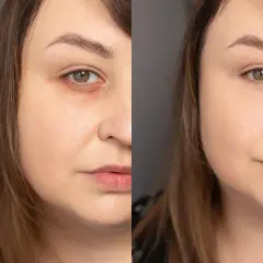 Porównanie twarzy: przed i po nałożeniu korektora pod oczy.