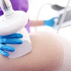 Endermologia krok po kroku: Jak wygląda zabieg i czy boli?