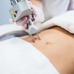 Liposukcja kawitacyjna: Jak często dla trwałych efektów?