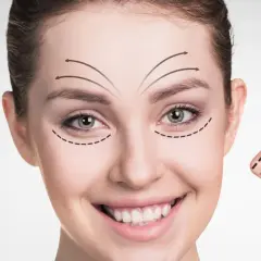 Twarz z zaznaczonymi liniami wskazującymi kierunek liftingu i korekty.