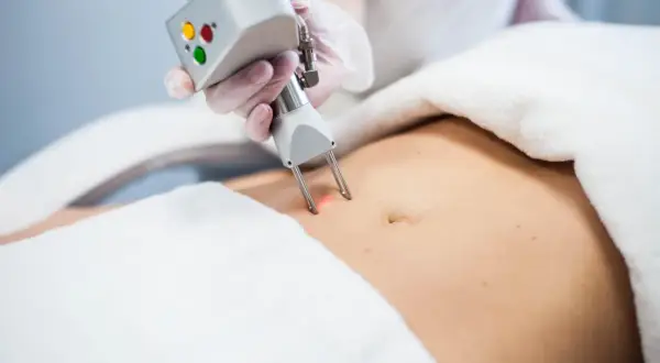Liposukcja kawitacyjna: Jak często dla trwałych efektów?