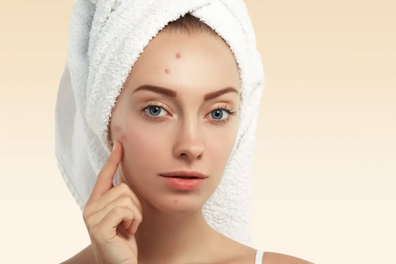 wizyta u dermatologa trądzik