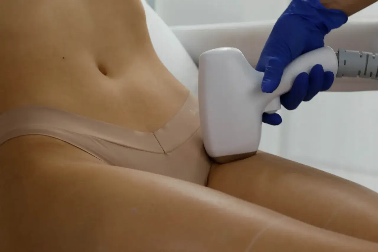 depilacja laserowa bikini przebieg