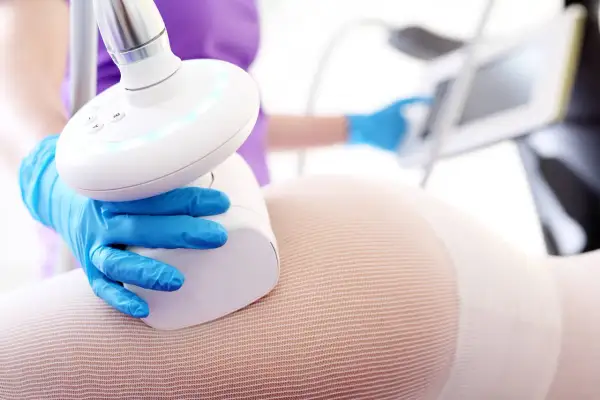 Endermologia krok po kroku: Jak wygląda zabieg i czy boli?